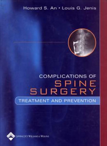 Picture of COMPLICATIONS OF SPINE SURGERY - TREATMENT AND PREVENTION
