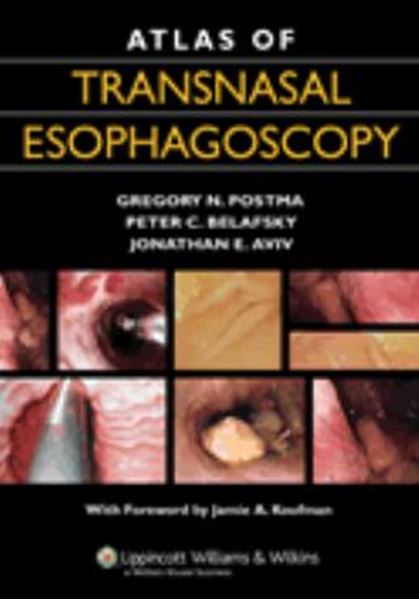 Picture of ATLAS OF TRANSNASAL ESOPHAGOSCOPY