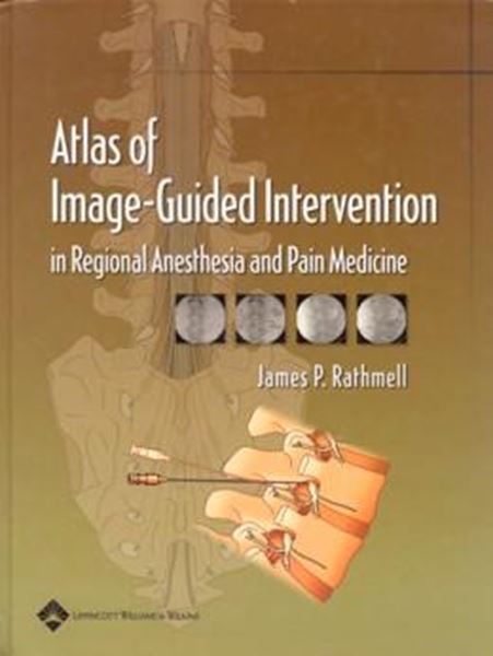 Picture of ATLAS OF IMAGE-GUIDED INTERVENTION IN REGIONAL ANESTHESIA AND PAIN MEDICINE