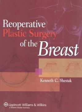 Imagem de REOPERATIVE PLASTIC SURGERY OF THE BREAST