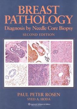 Imagem de BREAST PATHOLOGY - DIAGNOSIS BY NEEDLE CORE BIOPSY