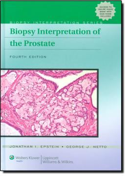 Imagem de BIOPSY INTERPRETATION OF THE PROSTATE