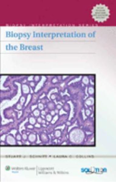 Picture of BIOPSY INTERPRETATION OF THE BREAST