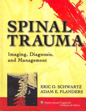 Imagem de SPINAL TRAUMA - IMAGING, DIAGNOSIS, AND MANAGEMENT