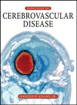 Imagem de PRINCIPLES OF CEREBROVASCULAR DISEASE