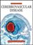 Imagem de PRINCIPLES OF CEREBROVASCULAR DISEASE