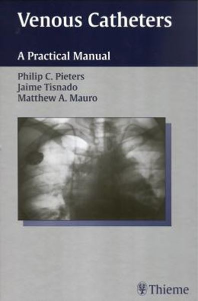 Picture of VENOUS CATHETERS