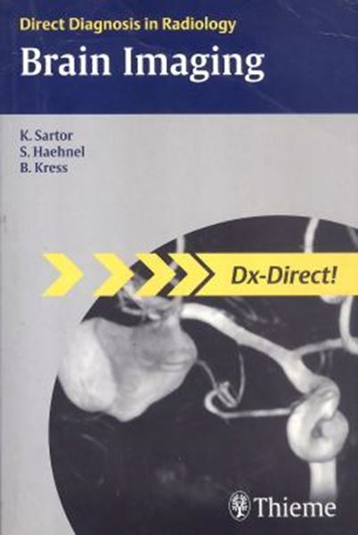 Picture of BRAIN IMAGING