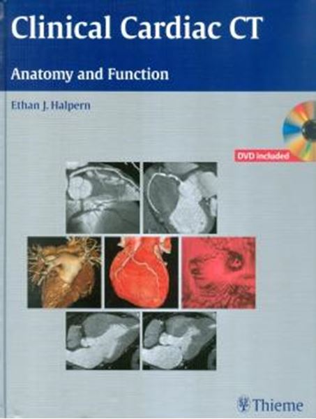Picture of CLINICAL CARDIAC CT ANATOMY AND FUNCTION (BOOK & DVD ROM)