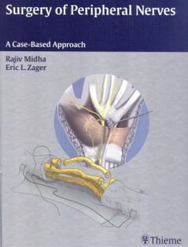 Imagem de SURGERY OF PERIPHERAL NERVES - 1ST ED