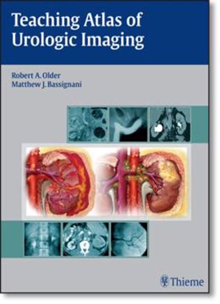 Picture of TEACHING ATLAS OF UROLOGIC IMAGING