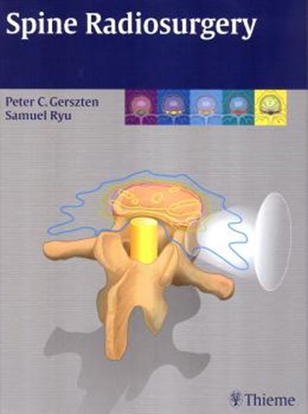 Picture of SPINE RADIOSURGERY