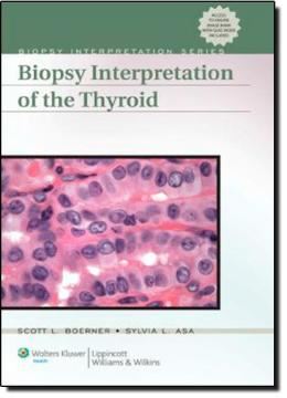 Imagem de BIOPSY INTERPRETATION THYROID