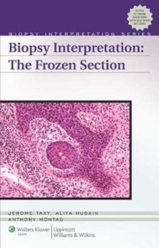 Imagem de BIOPSY INTERPRETATION FROZEN