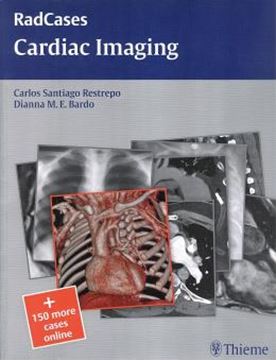 Imagem de CARDIAC IMAGING