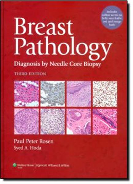 Picture of BREAST PATHOLOGY DIAGNOSIS - 3RD EDITION