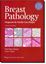 Imagem de BREAST PATHOLOGY DIAGNOSIS - 3RD EDITION