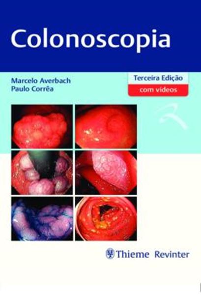 Picture of COLONOSCOPIA