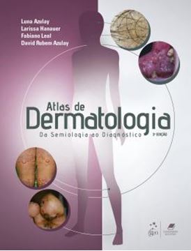Imagem de ATLAS DE DERMATOLOGIA - DA SEMIOLOGIA AO DIAGNOSTICO - 3ª ED.