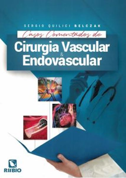 Picture of CASOS COMENTADOS DE CIRURGIA VASCULAR E ENDOVASCULAR - 1ª ED.