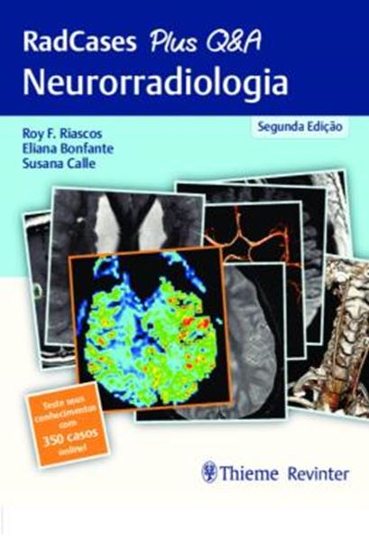 Picture of RADCASES PLUS Q&A - NEURORRADIOLOGIA