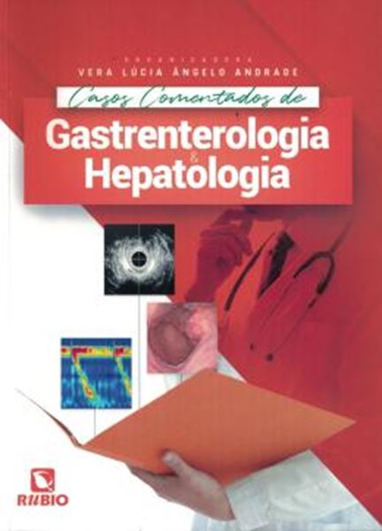 Picture of CASOS COMENTADOS DE GASTRENTEROLOGIA E HEPATOLOGIA