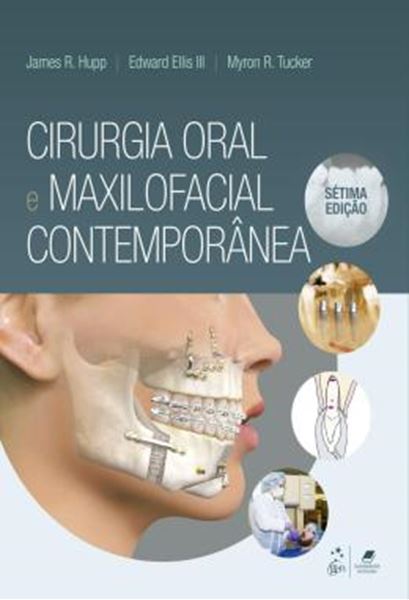 Picture of CIRURGIA ORAL E MAXILOFACIAL CONTEMPORANEA- 7ª ED.