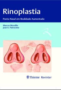 Imagem de RINOPLASTIA - PONTA NASAL EM REALIDADE AUMENTADA