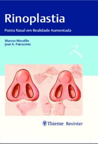 Picture of RINOPLASTIA - PONTA NASAL EM REALIDADE AUMENTADA