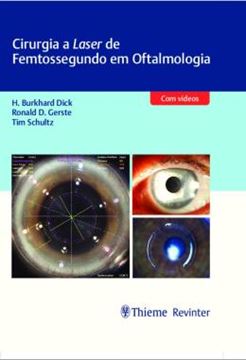 Imagem de CIRURGIA A LASER DE FEMTOSSEGUNDO EM OFTALMOLOGIA