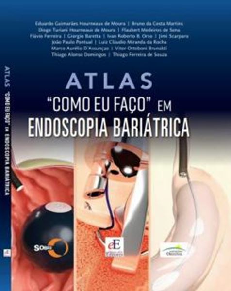 Picture of ATLAS COMO EU FACO CIRURGIA BARIATRICA