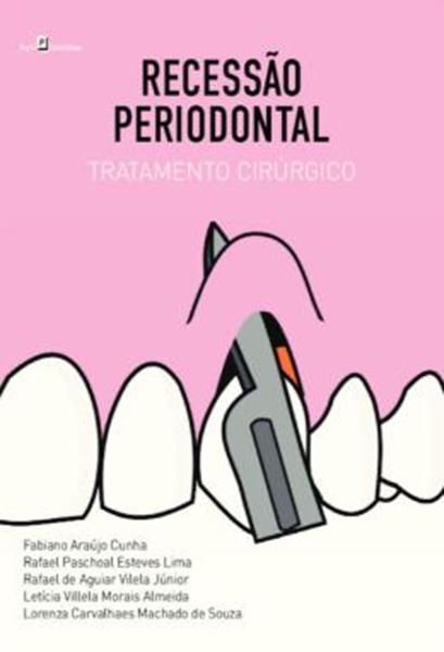 Picture of RECESSAO PERIODONTAL - TRATAMENTO CIRURGICO