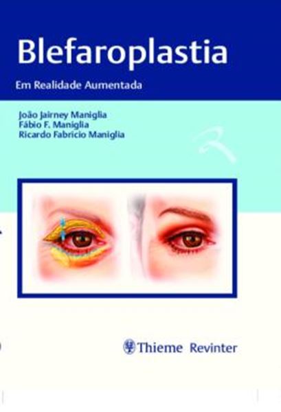 Picture of BLEFAROPLASTIA - EM REALIDADE AUMENTADA