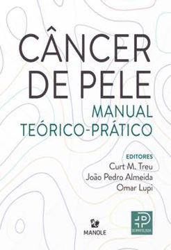 Imagem de CANCER DE PELE - MANUAL TEORICO-PRATICO
