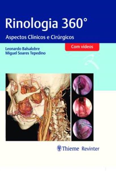 Picture of RINOLOGIA 360° - ASPECTOS CINICOS E CIRURGICOS