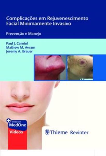 Picture of COMPLICACOES EM REJUVENESCIMENTO FACIAL MINIMAMENTE INVASIVO - PREVENCAO E MANEJO