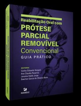 Imagem de REABILITACAO ORAL COM PROTESE PARCIAL REMOVIVEL CONVENCIONAL