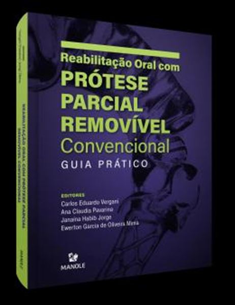 Picture of REABILITACAO ORAL COM PROTESE PARCIAL REMOVIVEL CONVENCIONAL