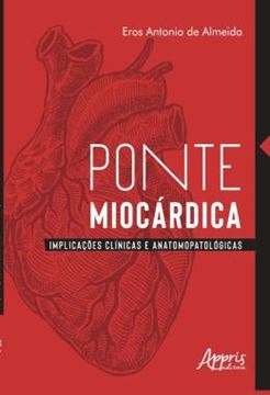 Imagem de PONTE MIOCARDICA - IMPLICACOES CLINICAS E ANATOMOPATOLOGICAS
