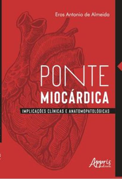 Picture of PONTE MIOCARDICA - IMPLICACOES CLINICAS E ANATOMOPATOLOGICAS