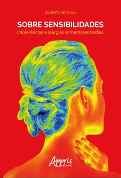 Picture of SOBRE SENSIBILIDADES: INTOLERANCIAS E ALERGIAS ALIMENTARES TARDIAS
