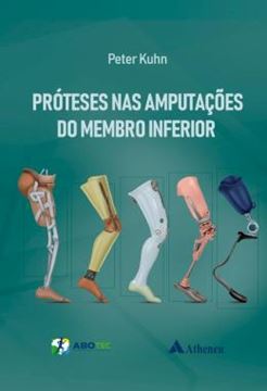 Imagem de PROTESES NAS AMPUTACOES DO MEMBRO INFERIOR