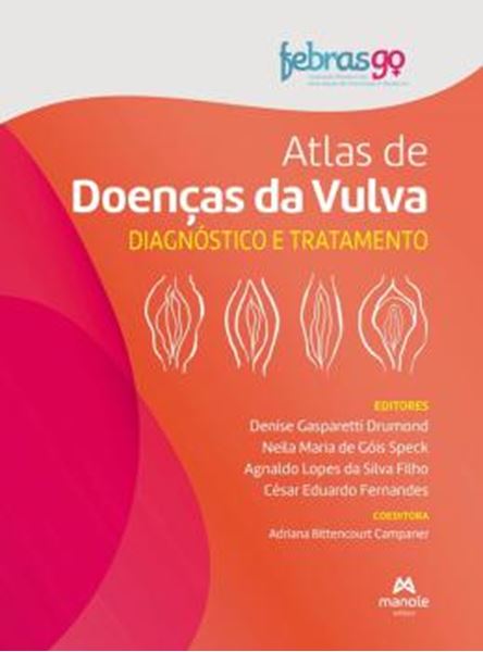 Picture of ATLAS DE DOENCAS DA VULVA
