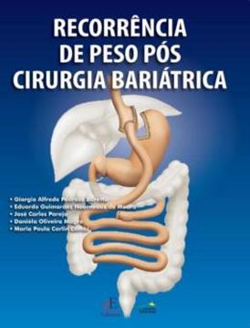 Imagem de RECORRENCIA DE PESO POS CIRURGIA BARIATRICA
