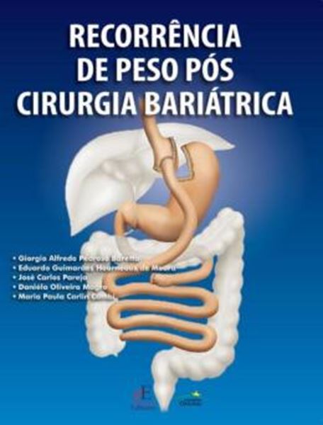 Picture of RECORRENCIA DE PESO POS CIRURGIA BARIATRICA