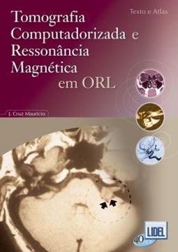 Imagem de TOMOGRAFIA COMPUTADORIZADA E RESSONANCIA MAGNETICA EM ORL