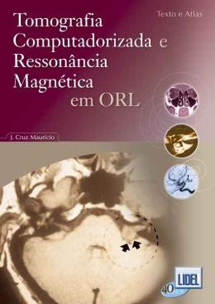 Picture of TOMOGRAFIA COMPUTADORIZADA E RESSONANCIA MAGNETICA EM ORL