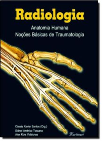 Picture of RADIOLOGIA - ANATOMIA HUMANA - NOCOES BASICAS DE TRAUMATOLOGIA