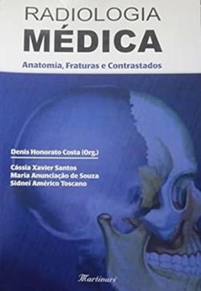 Picture of RADIOLOGIA MEDICA - ANATOMIA, FRATURA E CONTRASTADOS
