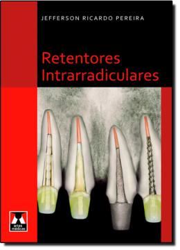 Imagem de RETENTORES INTRARRADICULARES